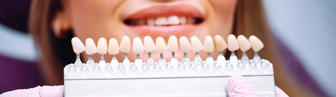 Veneers Dentist 11366