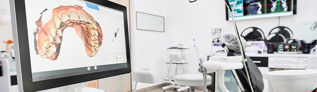 iTero® Digital Scanning in Flushing NY