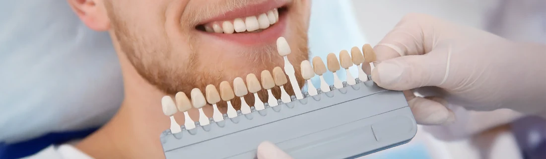 Dental Veneers in Flushing NY