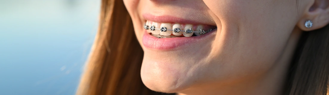 Orthodontics in Flushing NY