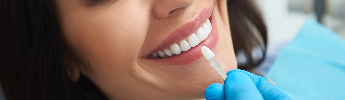 Veneers Dentist Jamaica Estates Queens NY